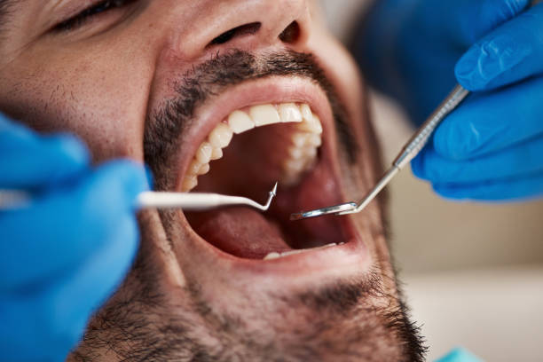 Dental X-Rays and Imaging in Upper Pohatcong, NJ